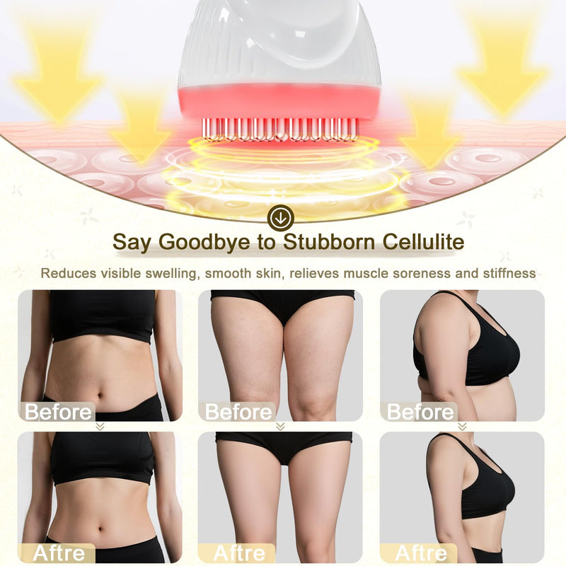 [Australia] - 2025 Upgraded Lymphatic Drainage Massager Body Sculpting Machine Helps Reduce Stretch Marks & Cellulite for Legs, Arms & Belly Anti Cellulite Massage Tool with Light Heat & Vibration 