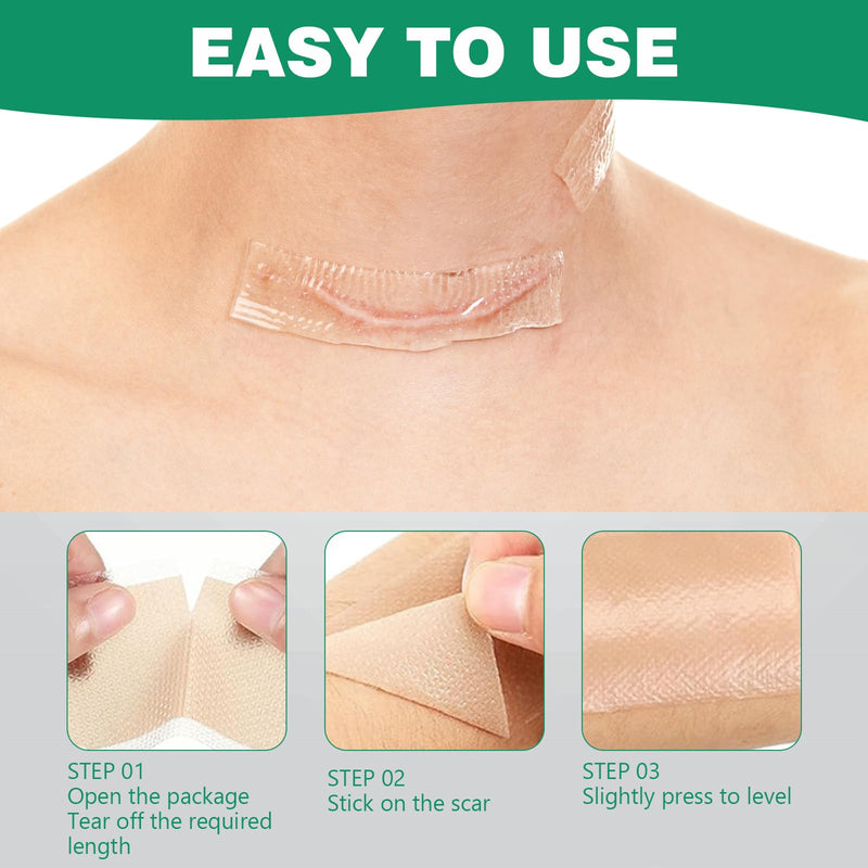 [Australia] - Silicone Plaster for Scars Scar Plaster Silicone Scar Tape Silicone Plaster for Scars Scar Tape Ultra Thin Soft and Breathable Suitable for Burns and Cesarean Section Scars (4 * 150 cm) 