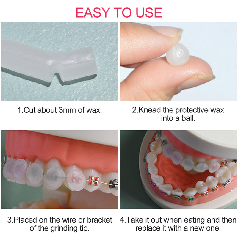 [Australia] - Newpop Pack of 10 Braces Wax, Orthodontic Wax, Dental Wax for Braces to Relieve Irritation and Pain 