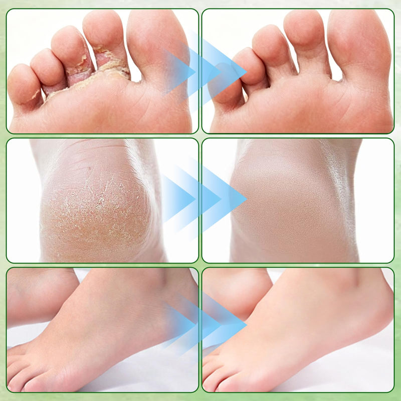 Tea Tree Oil Foot Cream 50g, with Vitamin E, Aloe Vera & Peppermint, Nourishing & Hydrating Foot Balm for Dry Feet Care, Travel-Size Foot Care Products (2PCS)