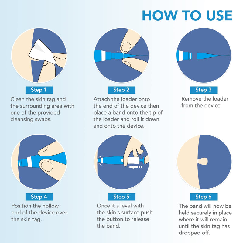 [Australia] - Skin tag remover, auto skin tag remover kit, 2-in-1 stalk wart removal quick kit, safe and pain-free, 2-8 mm bands with 40 tag bands & 36 skin tag removal patches 87-piece set 