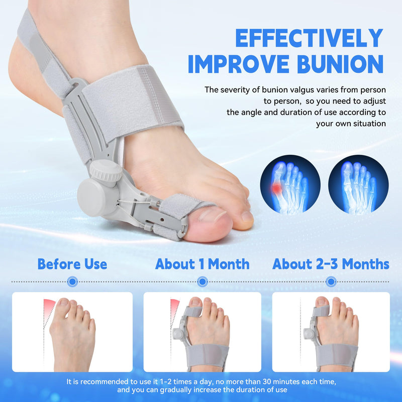 [Australia] - Bunion Corrector for Men & Women, Left Foot Big Toe Straightener, 3-in-1 Complete Set of Relief, Bunion Splint for Bunion Fix, for Bunions and Hallux Valgus (Left Foot) Left Foot 1pcs 