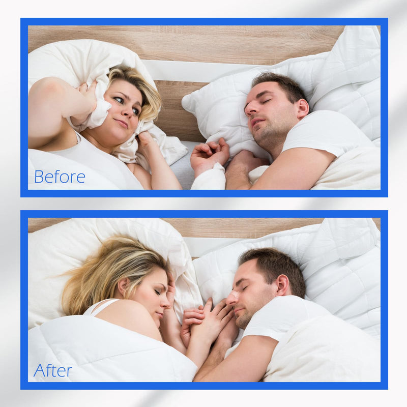 [Australia] - Upgraded Version - Invisible and Transparent Nasal Strips (66mm*19mm) (100) 100 