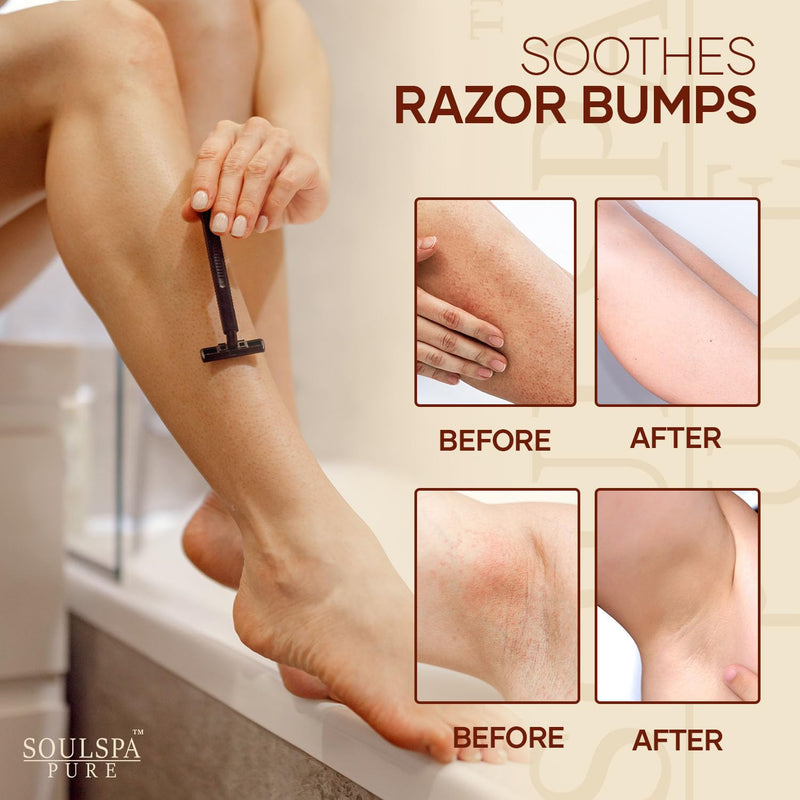 [Australia] - Ingrown Hair Serum - Powerful Razor Bump Solution for Bikini Area, Face & Brazilian Wax - Ingrown Hair Oil that Soothes, Exfoliates & Nourishes - 2 fl oz 