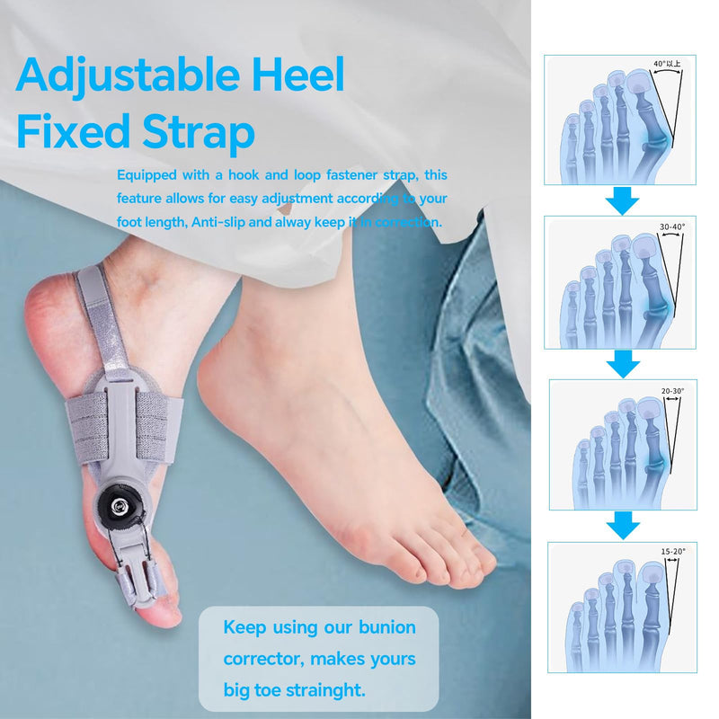 [Australia] - Bunion Corrector for Men and Women Big Toe, Adjustable Splint for Hallux Valgus Correction with Anti-slip Heel Strap and Detachable Silicone Pad, Toe Separators Pack(Gray) Gray 