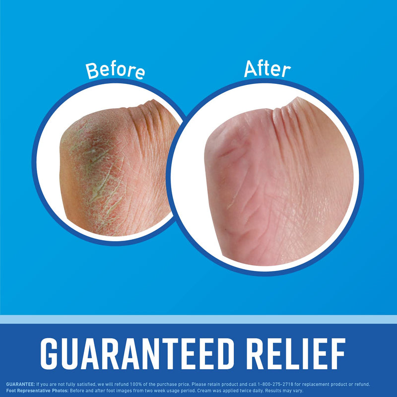 O'Keeffe's Working Hands Hand Cream, 6.8 oz Jar and Healthy Feet Foot Cream, 6.4 oz Jar - Repairing Skincare for Extremely Dry, Cracked Hands and Feet 13.2 Ounce (Pack of 1)