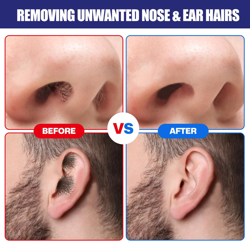 [Australia] - Nose Wax Kit, 120 g Wax, 30 Applicators,Nostril and Ears Hair Removal Kit for Men & Women,Includes 15 Balm Wipes and Mustache Guards etc. Lasts up to 6 Weeks Standard Nose Waxing Kit 