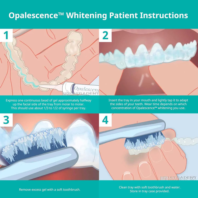 Opalescence 10% Teeth Whitening Kit - Gel Syringes Refills - Low Sensivity (4 Syringes) - Fluoride, Carbamide Peroxide - Made in The USA by Ultradent 5211-2