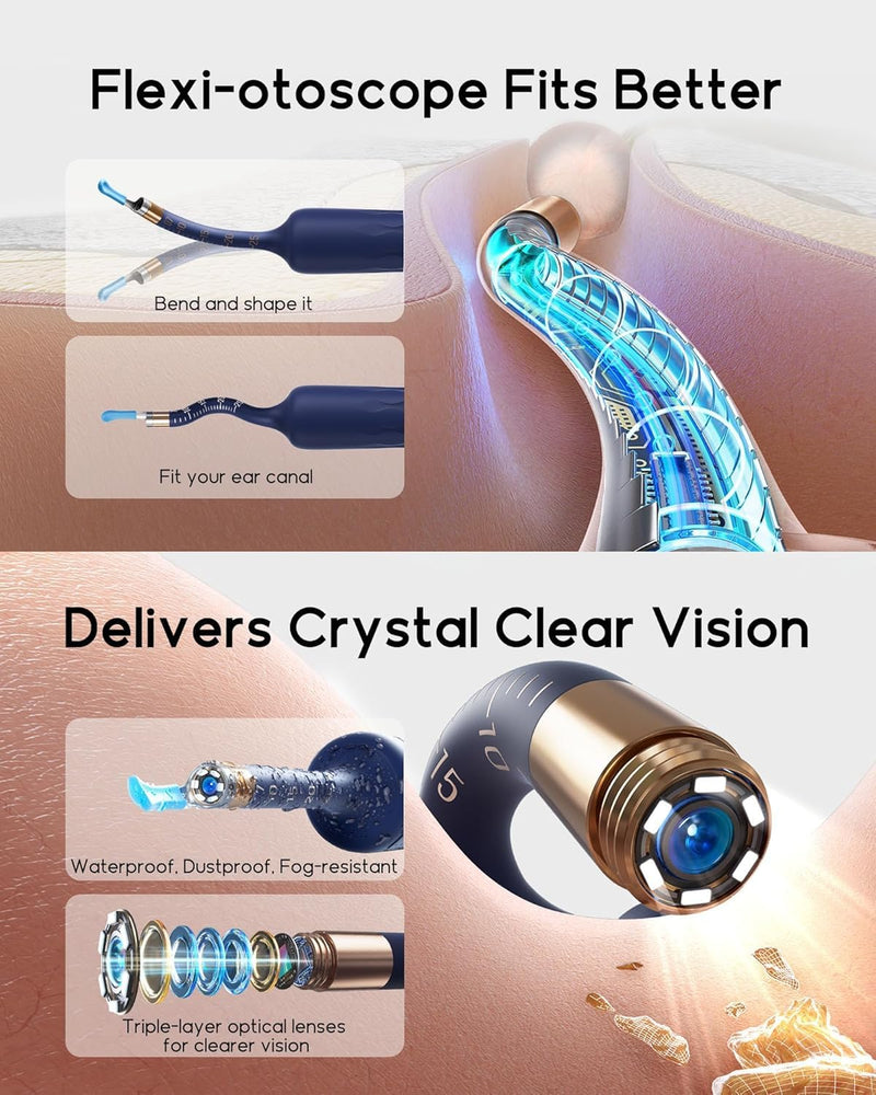 [Australia] - Bebird Earsight Plus D39R Ear Wax Removal Tool Camera, FSA HSA Eligible Items, Ear Cleaner with Flexible Ear Camera Otoscope, Visual Ear Pick Tweezers Wax Remover, Ear Cleaning Kit for Family 