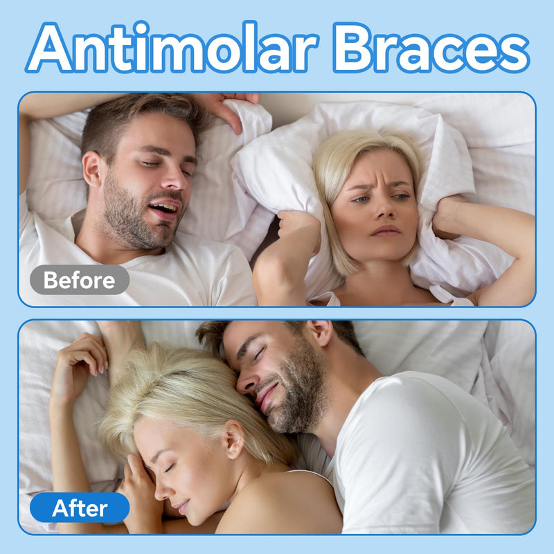 Mouth Guard for Grinding Teeth at Night, 6 Pack Nightguards for Teeth Clenching for Sleeping Bite Guard for Teeth Adults, No Boiling or Molding, Universal Size One Size Fits All