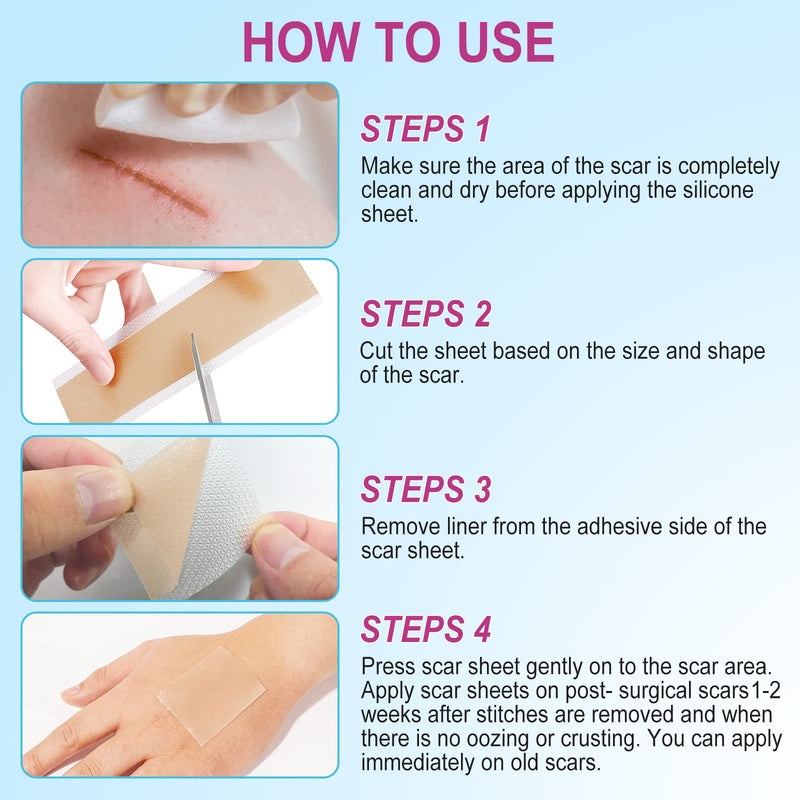 [Australia] - silicone scar tape, silicone plaster for scars, silicone scar sheets, silicone scar cloths (1.6" x 75")-1.9M, silicone scar sheets, professional for scars through C section, silicone scar plaster 1 pack 1.6" 