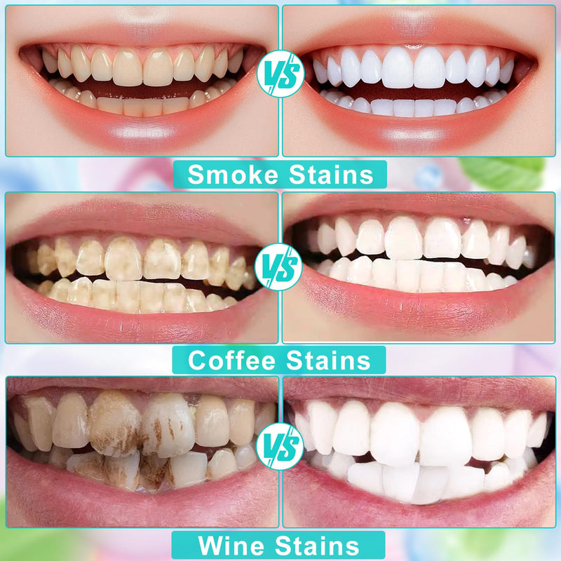 Niacinamide Whitening Toothpaste Natural Mild and Non-Irritating Nicotinamide White Toothpaste Prevents Tooth Decay Freshens Breath, and Promotes Oral Health 1