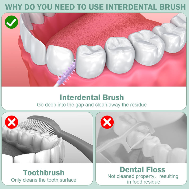 600 Pcs Soft Interdental Brushes Disposable Gum Picks Dental Floss with Case Picks Dental Braces Brush for Teeth Cleaning and Gum Health 600