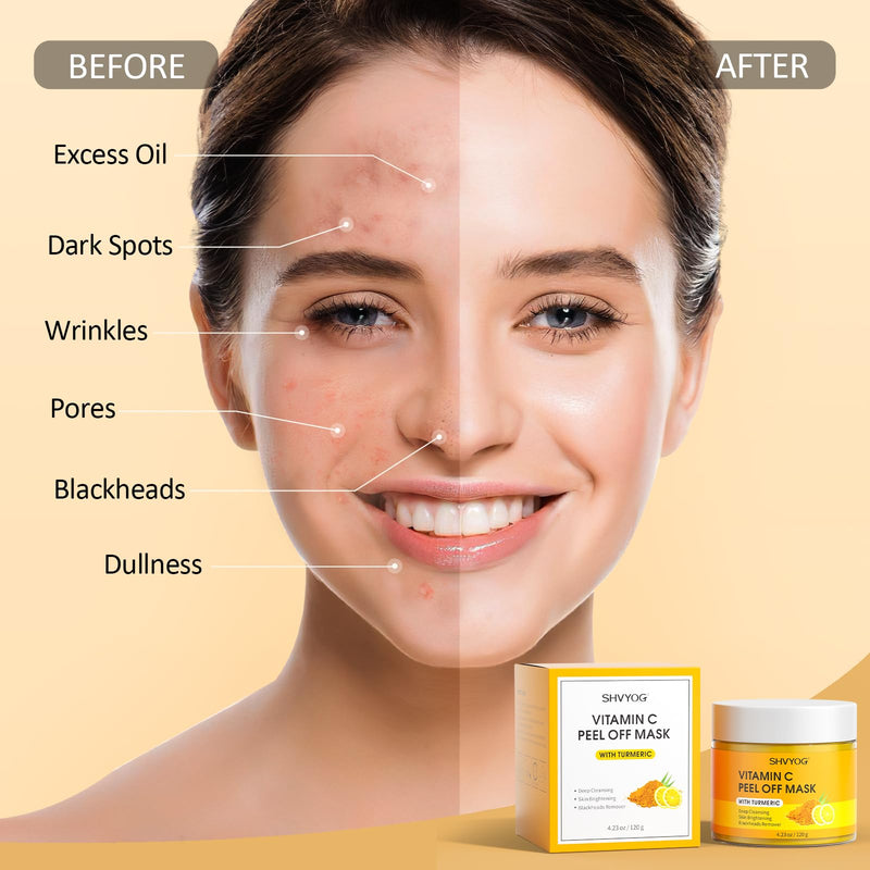 SHVYOG Vitamin C Peel Off Face Mask, Peel Off Mask with Turmeric, Blackhead Remover & Deep Cleansing Face Peel Mask, Vitamin C Exfoliating Face Mask for Blackheads, Large Pores, Dirts, Oil VC 5.29 Fl Oz (Pack of 1)