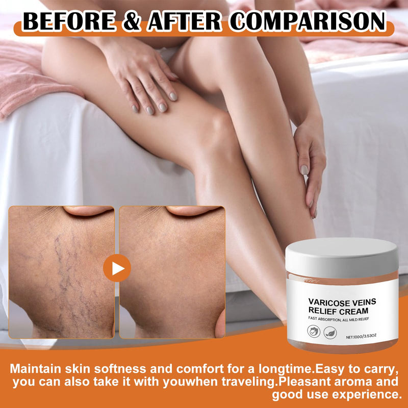 [Australia] - LETTERASHQP Varicose Veins Relief Cream Varicose Veins Cream Varicose Veins Cream Medilisk Varicose Veins Cream Spider Veins Cream Relief Cream for Varicose Veins Cream for the relief of varicose veins 