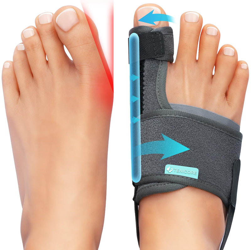 [Australia] - TENICORE Hallux Valgus Correction with 2 Angle Irons Hallux Valgus Splint Non-Slip Strap Bunion Toe Separator Toe Protector 1 Pair 