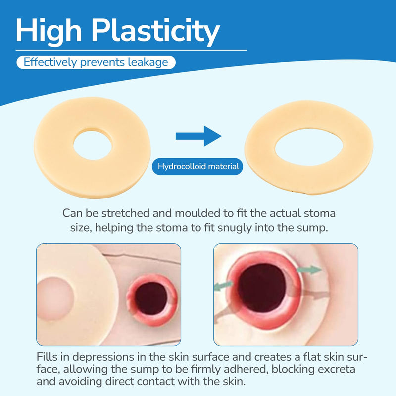 [Australia] - 10PCS Ostomy Barrier Rings, Ostomy Supplies, 2mm Thickness Moldable Ostomy Rings Medical Grade Hydrocolloid Adhesive Barrier Rings Better Seal for Ostomy Bags (Box of 10) 2mm Ostomy Barrier Rings 