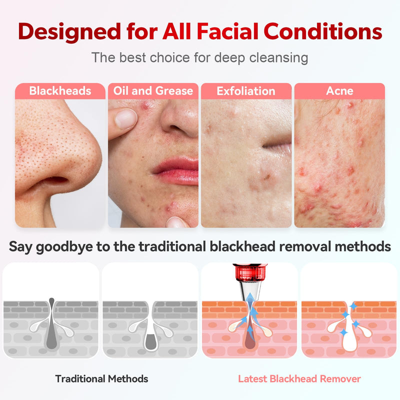 Blackhead Remover Pore Vacuum Upgraded Facial Pore Cleaner Electric Comedone Whitehead Extractor Tool-5 Suction Power,5 Probes,USB Rechargeable Blackhead Vacuum Kit for Women & Men Red