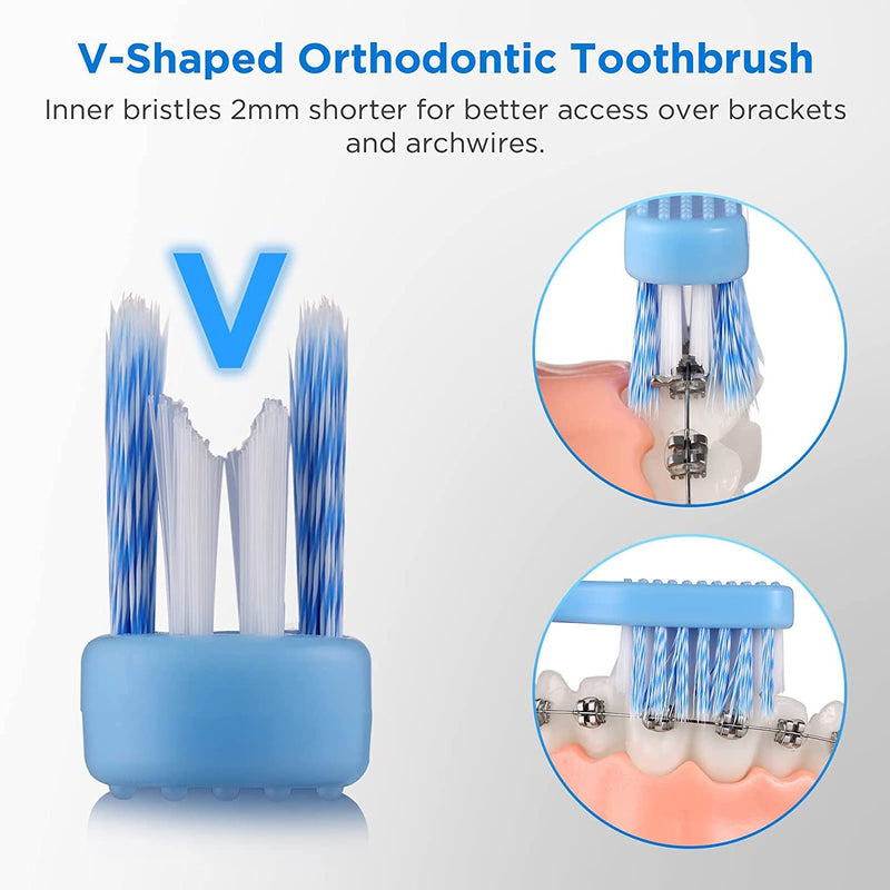 [Australia] - V-Shaped Orthodontic Toothbrush for Braces, Soft Bristles, 6 Count, with Interdental Brushes V Shaped 