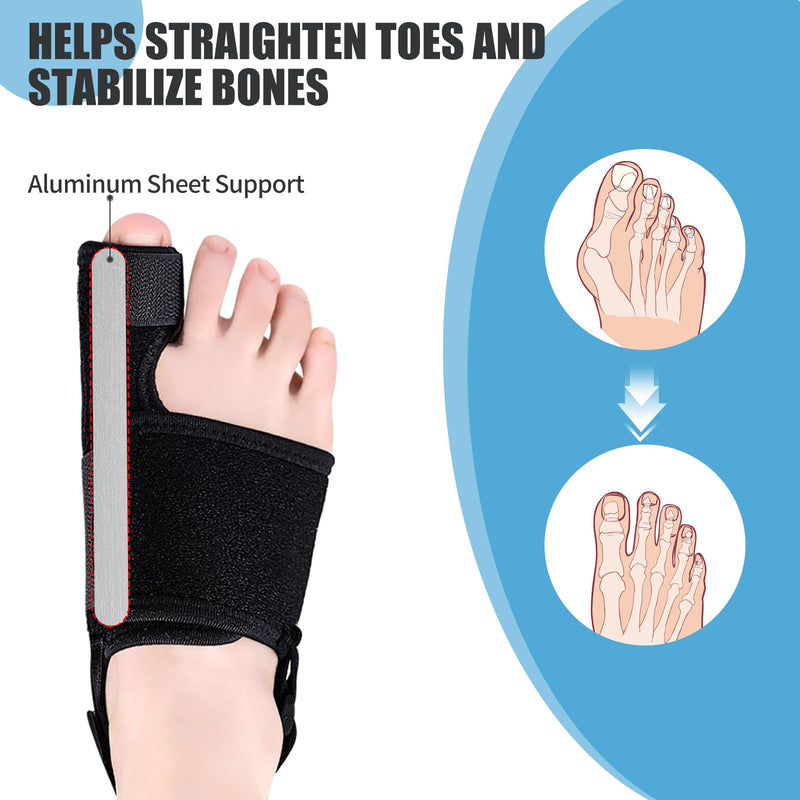 Recovist Bunion Brace for Women & Men - Recovist Bunion Corrector & Big Toe Straightener. alleviation Pain & Corrects Toe Alignment. For Left & Right Foot (1 Pair)