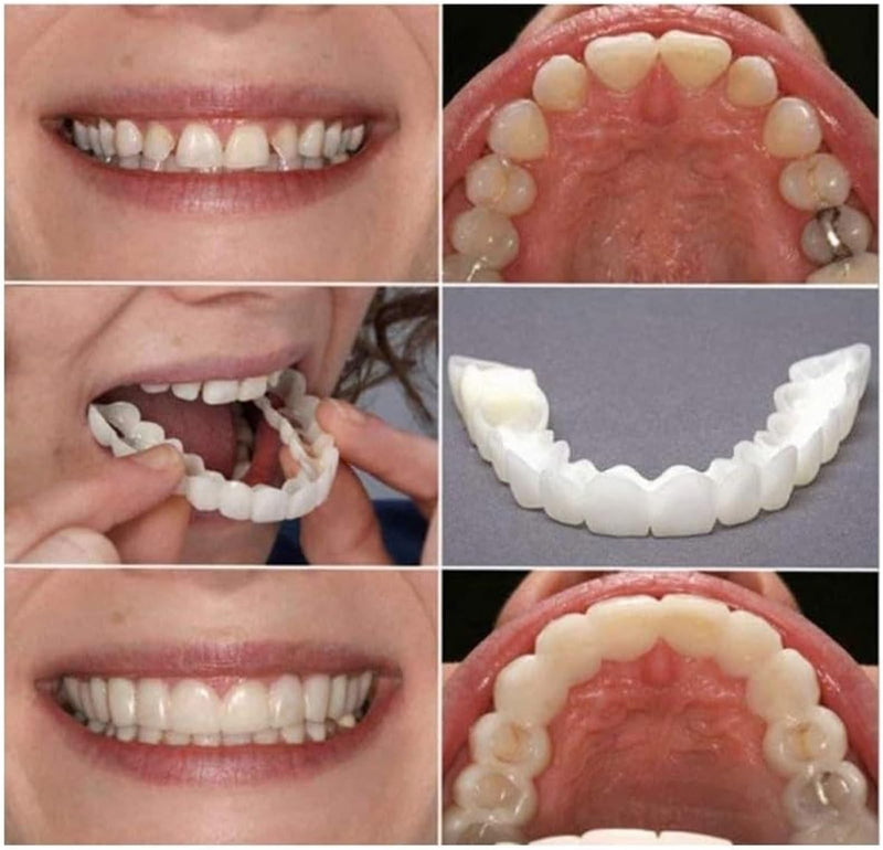 2 Pairs,Temporary Smile Solution, Adjustable & Comfortable.(White) (2)