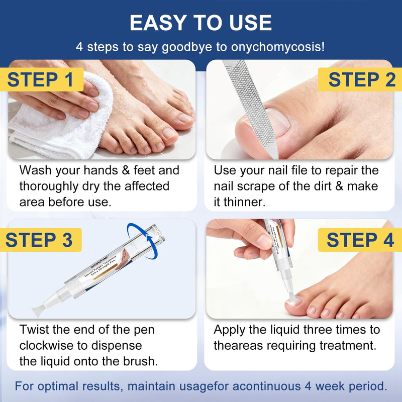Toenail Fungi Treatment Extra Strength - Fungi Nail Pen, 25% Undecylenic Acid, Ingrown toenail treatment, Fungus nail treatment, yellow toenail, Damaged Nails foot fungus treatment extra strength 0.17 Fl Oz (Pack of 4) 4pcs