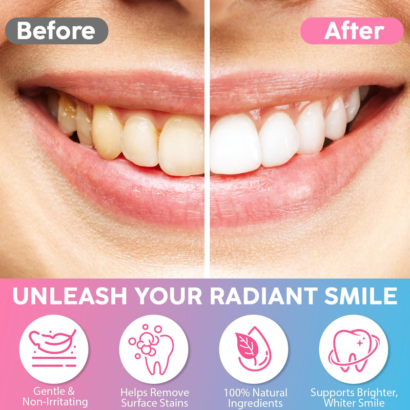 [Australia] - Niacinamide Whitening Toothpaste, Niacinamide Intensive Toothpaste - Deep Stain Removal & Improves Gum Health (3Pack) 