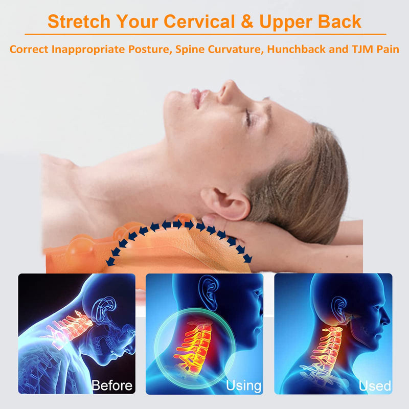 [Australia] - Cervical Traction Device Pillow Neck Stretcher Equipment for TMJ Neck Pain Relief Neck and Shoulder Relaxer with Upper Back Massage Cervical Spine Alignment Chiropractic Pillow 