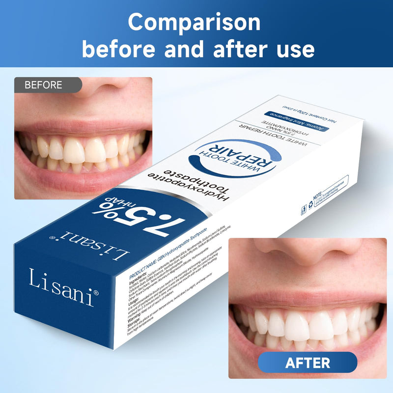 Set 2-Pack Hydroxyapatite Toothpaste for Teeth Remineralization, Enamel Repair, Sensitivity Relief & Whitening Fluoride-Free, Deep Cleaning Care, Fresh Breath White-b