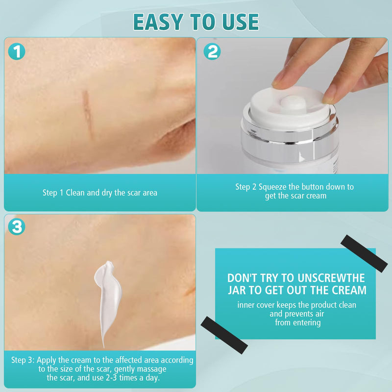 [Australia] - Advanced Scar Cream, Silicone Gel for Scars, Professional Scar Removal Cream for Surgical Scars, Stretch Marks, Old and New Scars 1.7 oz(50ml) 