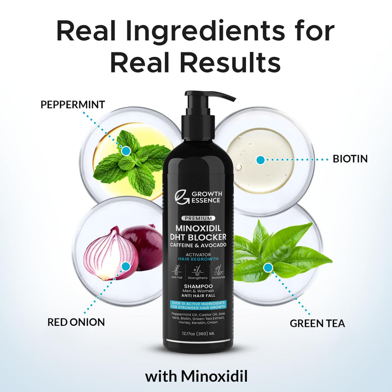 Minoxidil & Biotin Shampoo for Hair Growth - Enriched with Caffeine, Castor Oil & Onion - DHT Blocker for Thicker, Healthier Hair - Strengthening Formula for Men & Women