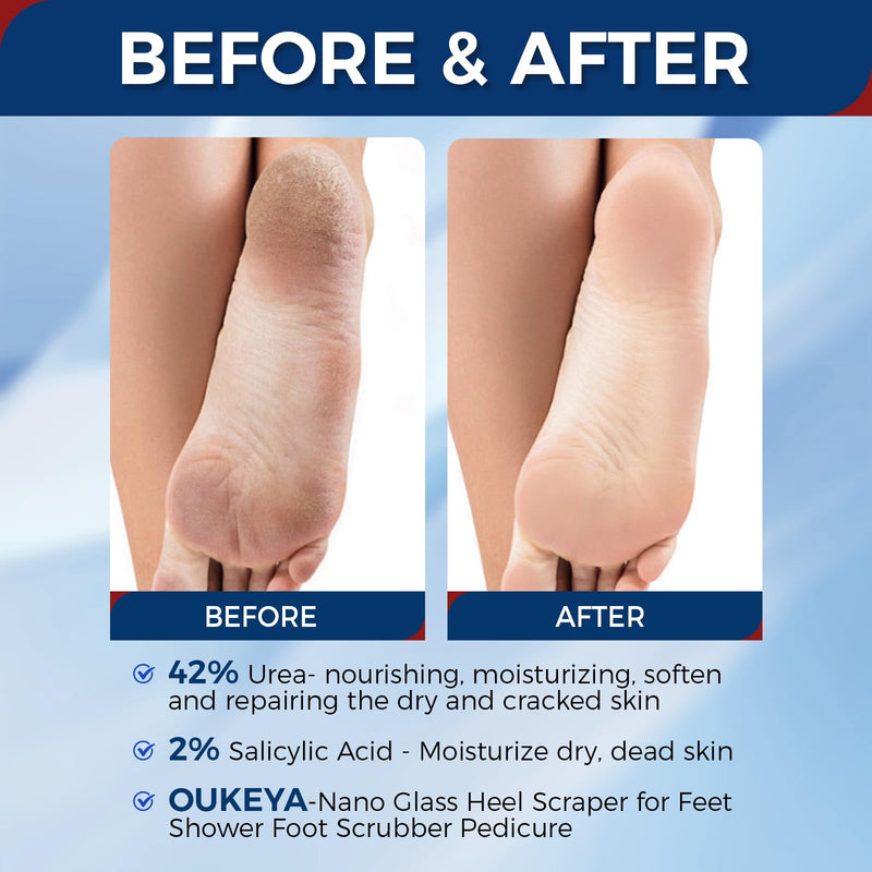 OUKEYA 42% Urea Cream for Dry Rough Skin, Contain Nano Glass Foot File | 3 Oz Tube, 2% Salicylic Acid, Moisturize Lotion, Exfoliating, Heels Care, Hands, Elbows Knees, Softening, Non-Greasy 3 Ounce with Foot File