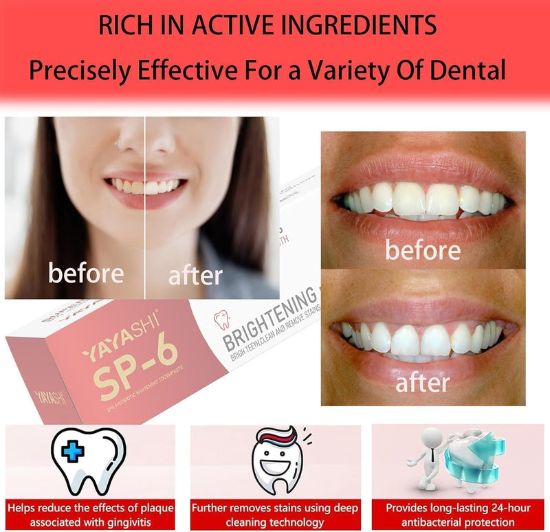 2-Pack SP-6 Probiotic Whitening Toothpaste - Enhanced Formula with 6 Probiotics for Teeth Whitening and Gum Health - Enamel-Safe, Fluoride-Free, Double Mint Flavor,Fresh Breath (Double Mint) 4.23 Fl Oz (Pack of 2)