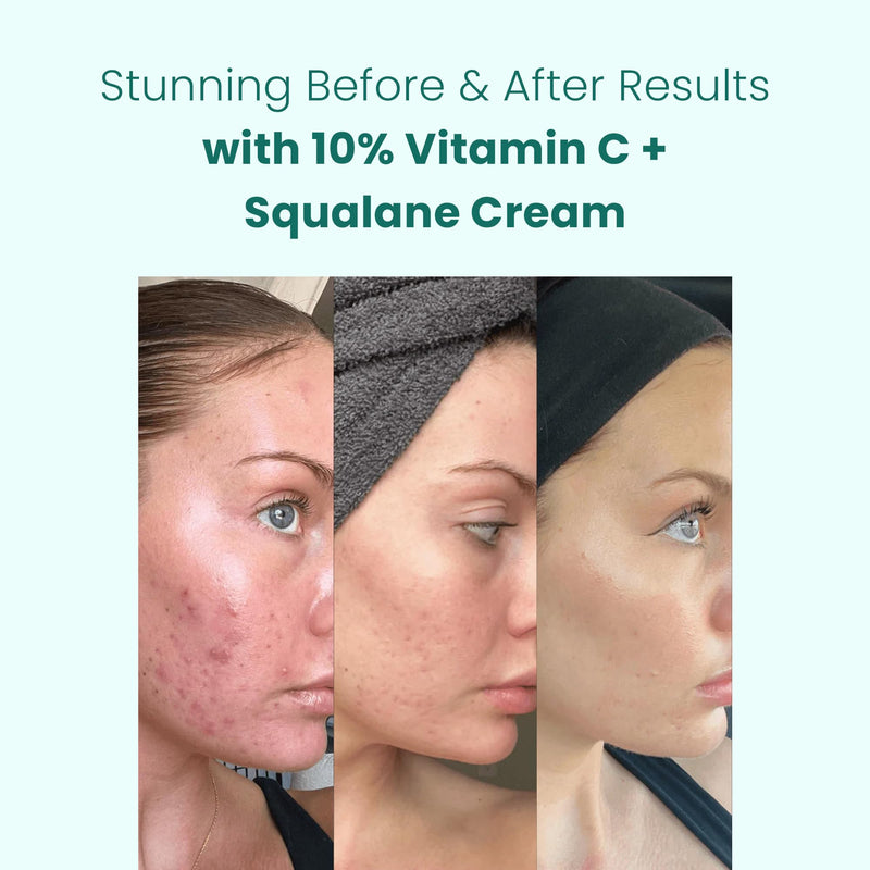 Gin Amber Beauty Vitamin C 10% + Squalane Repair Face Cream - 1 fl oz | Dark Spot Corrector - Primer , Brightening Daily Face Cream for Radiant-Looking Skin, Deep Hydration Vitamin C 10%