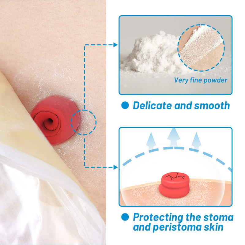 [Australia] - Heagied Stoma Powder, Skin Barrier Protection Ostomy Powder Supplies, Stoma Adhesive Powder, Ostomy Skin Care Powder, Ostomy Supplies(25g) 