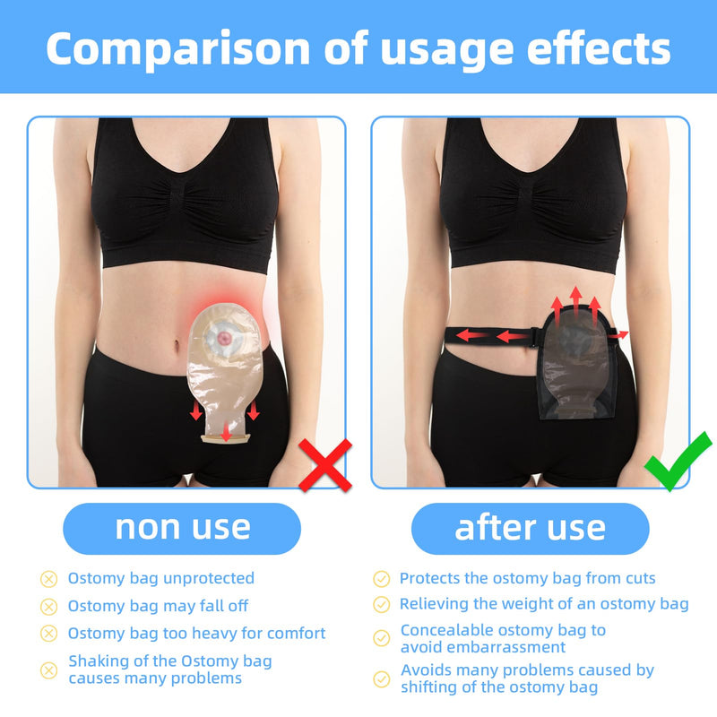 [Australia] - 2 Pack Waterproof Ostomy Bag Covers Universal Colostomy Bags Shower Cover for Ileostomy Ostomy Supplies Adjustable Stoma Pouch Protector for Men & Women 
