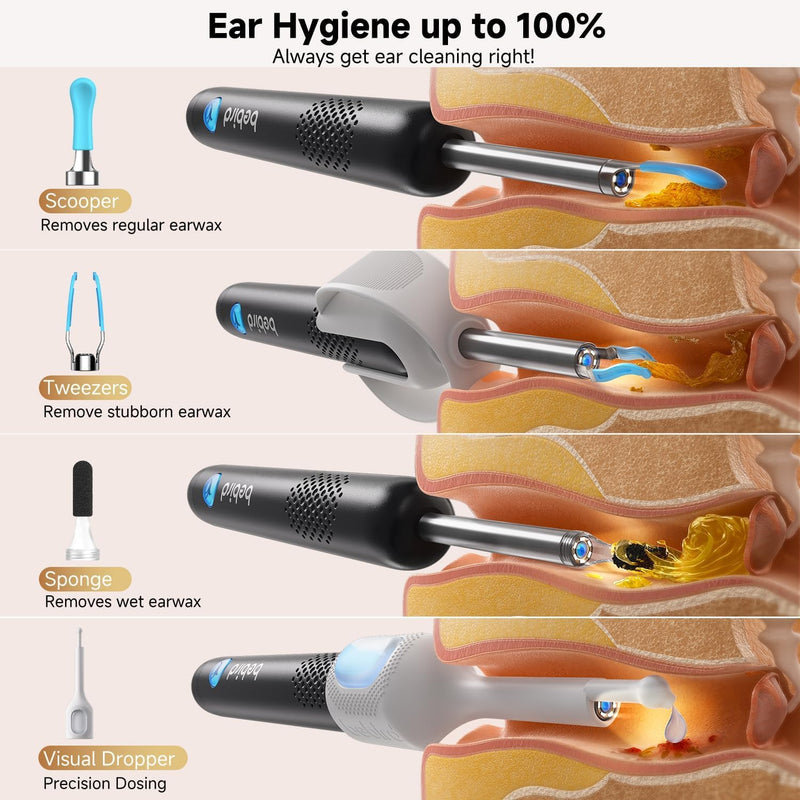 [Australia] - BEBIRD R1 Ultra Ear Wax Removal, Ear Cleaner with Camera Ear Scope, Wax Remove Ear Pick with Ear Otoscope Tweezers, Visual Dropper Cleaning Kit, Ear/Nose/Throat Examination Tool for Family 