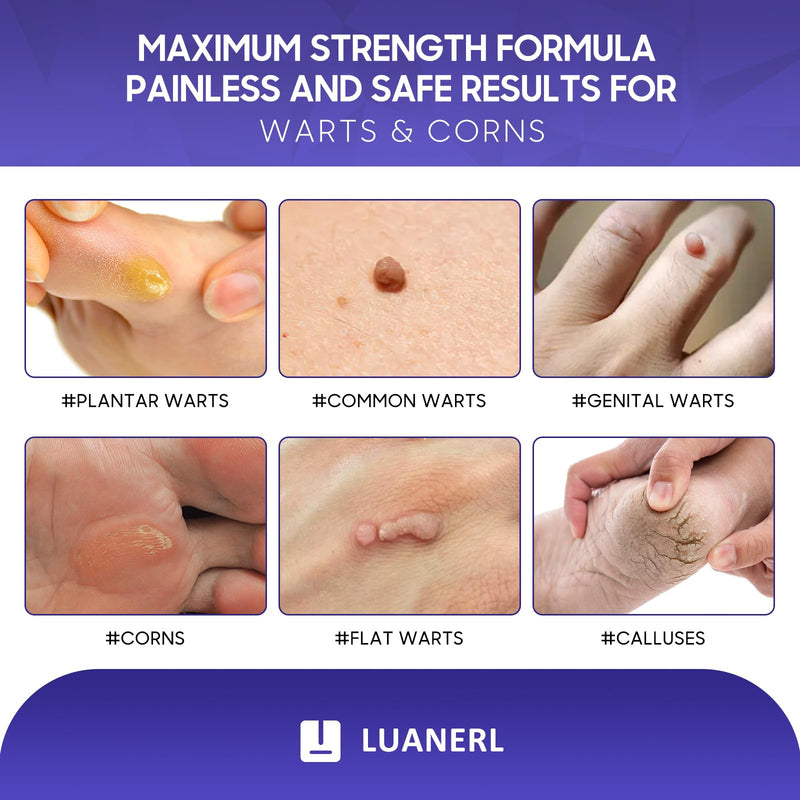 [Australia] - Wart & Corn Remover, 20% Salicylic Acid with Natural Formula, Maximum Strength Freeze Off, Fast-Acting for Warts, PlantarWart, GenitalWart, CommonWart, Callus-0.4 fl oz(12ml) 