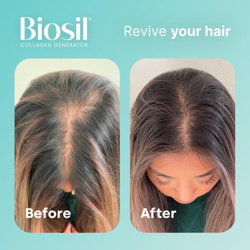 Biosil Collagen Generator - 15 mL Drops - with Patented ch-OSA Complex - Generates & Protects Your Own Collagen - GMO Free - 30-Day Supply