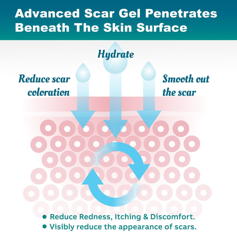[Australia] - Scar gel 50g scar cream for C-section, operations, burns, keloid, acne, scar gel that can be used with scar tape (4cmx300cm) 