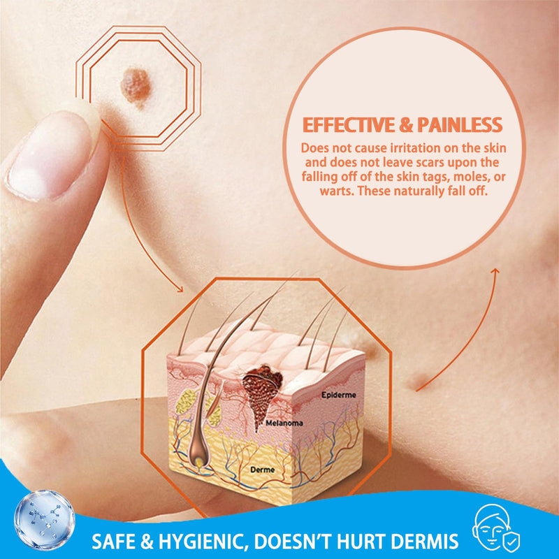 [Australia] - LIGUID WART Remover,Fast Action Wart Remover,Wart Liquid with Salicylic Acid, Plantar Wart, Common Wart, Flat Wart,Corn, Callus,1floz(30mL) 1 bottle 