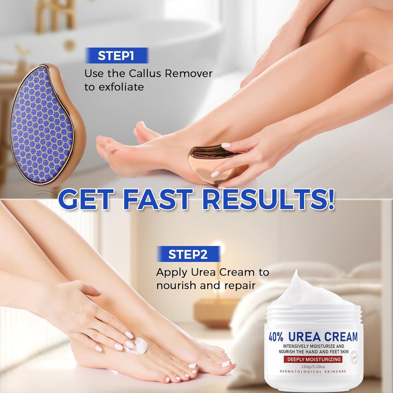 OUKEYA Urea Cream 40 Percent for Foot & Hand Cream with Foot Files for Dry Cracked,Urea Lotion for Feet Maximum Strength