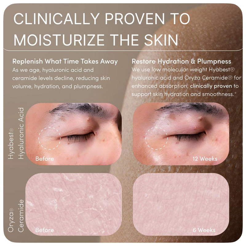 [Australia] - GLOW Anti Aging Supplement - Hyabest¬Æ Hyaluronic Acid, Phytoceramides, 5000 mcg Biotin, Vitamin A, C, E, Zinc - Hair Skin Nails Vitamins for Women & Men - Wrinkles & Skin Hydration - 60 Capsules 