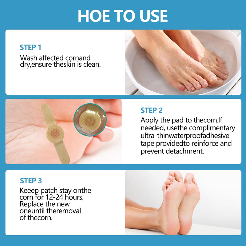 [Australia] - Corn removers for Toes feet Bottom of Foot Corn Remover(24 Count),Corn Pads Remover for Toes feet with 40% Salicylic 24 Count(1 pack) 