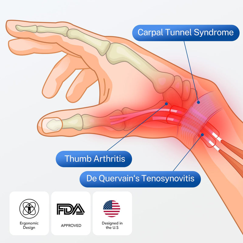 [Australia] - Fitomo 2-in-1 Thumb Brace for De Quervains Tenosynovitis, Arthritis, Click Finger, Tendonitis, Carpal Tunnel Pain Relief, Thumb Sprain Left-Blue S/M 
