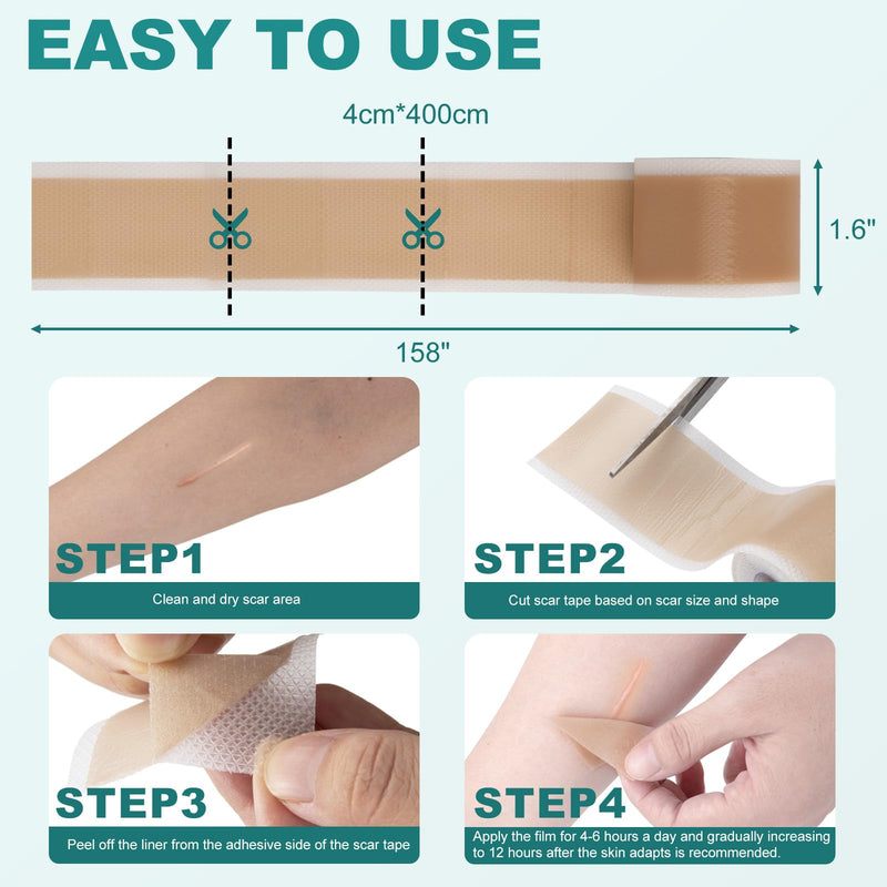[Australia] - Silicone Scar Sheets, Silicone Scar Tape(1.6"x 158"), Scar Tape for Scar Removal Treatment, Reusable Silicone Scar Strips for Surgical, C-Section, Keloid, Burn, Acne, Surgical Scars 1.6"x 158" 