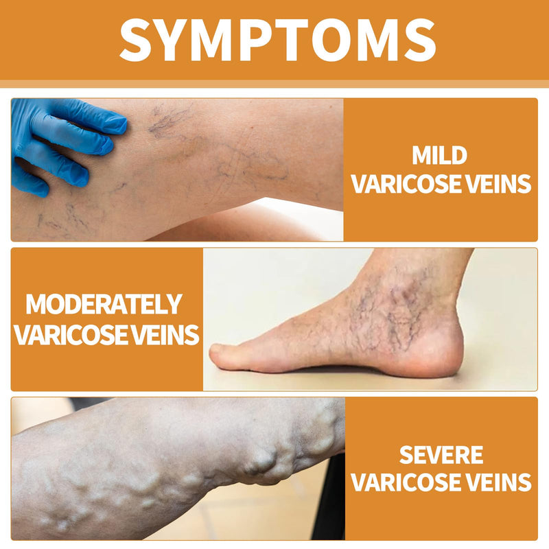 [Australia] - Grgowe varicose veins cream + vein repair spray, varicose veins cream, cream against spider veins, veins active, spider veins, relieves leg pain and swelling 