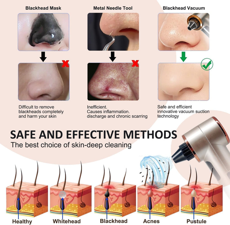 Blackhead Remover Vacuum with Heating, Blackhead Extractor 3 Adjustable Suction Levels 9 Modes, Pore Vacuum Blackhead Suction Remover, Comedone Extractor Kit for Deep Pore Cleaning (Golden) 1 Count (Pack of 1)