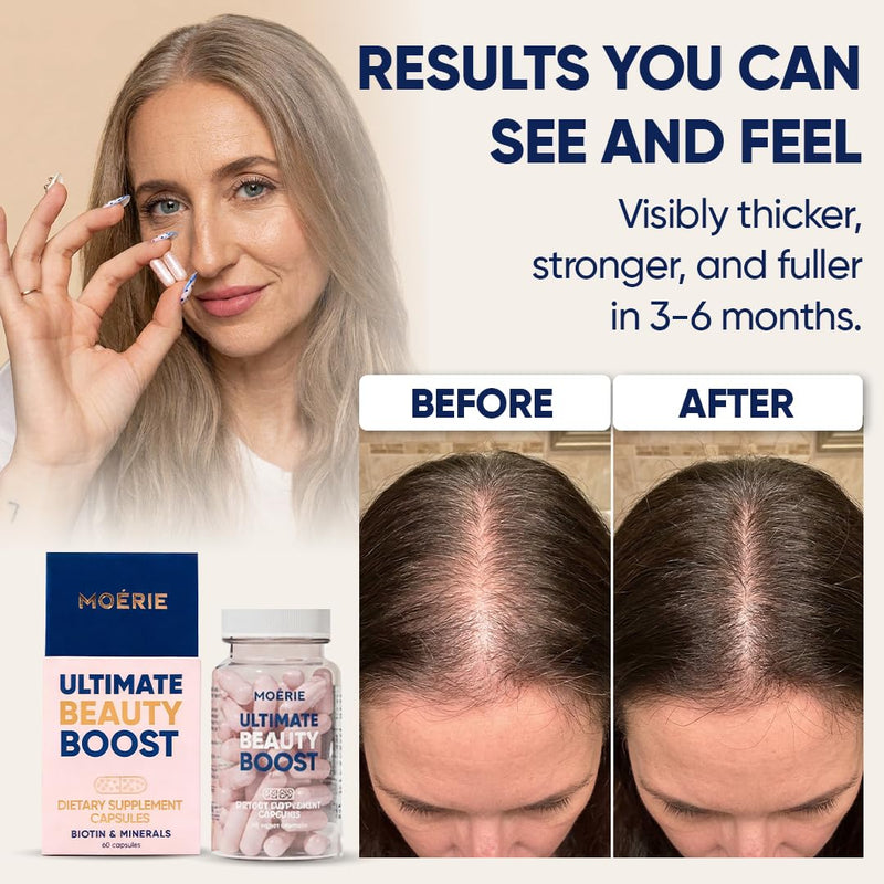 Moerie Ultimate Hair Boost Supplements for Women & Men - Hair, Skin, Nails Vitamins with Biotin & Minerals for Hair Health - Thicker Hair - 60 Capsules