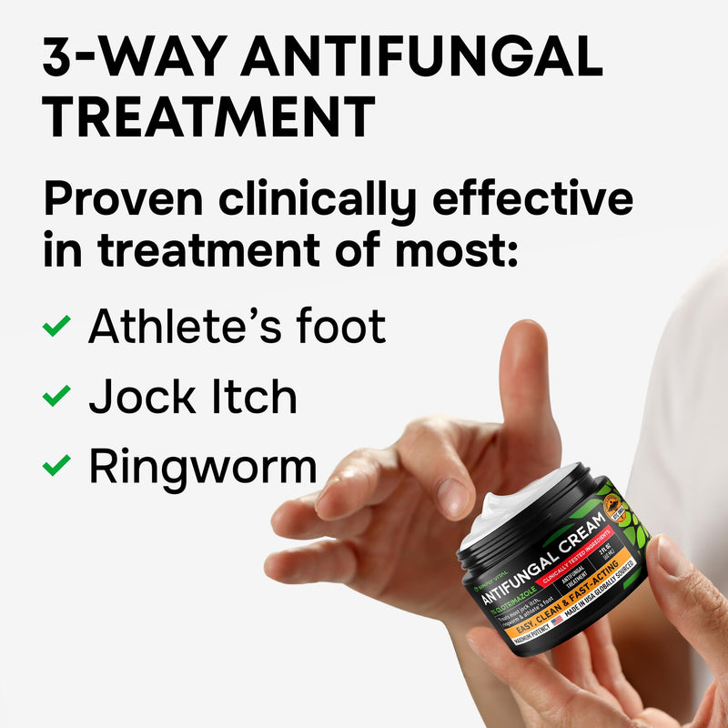 Clotrimazole 1% Antifungal Cream, Athlete's Foot Jock Itch Ringworm 2 oz | Athletes Foot Treatment, Anti Fungal Cream for Skin, Ring Worm Medication for Humans, Jock Itch Treatment, External Use Only 2 Fl Oz (Pack of 1)